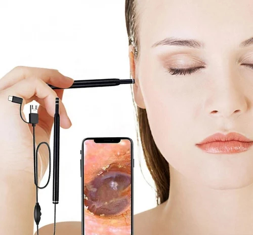 Ενδοσκοπική Κάμερα Αυτιών - Μικροσκόπιο με LED και USB για Καθαρισμό Ενδοσκοπική Κάμερα Αυτιών - Μικροσκόπιο με LED και USB για Καθαρισμό