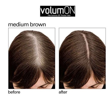 VolumON Hair Loss Concealer, κατά της Τριχόπτωσης & Αραίωσης των Μαλλιών 6gr