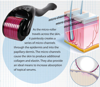 Micro NeedleRoller - Επαγγελματική μέθοδος Ανανέωσης & Αντιγήρανσης